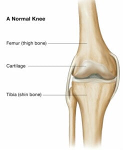 diagram of knee joint with labeled parts