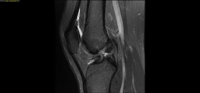 image of the inside of the knee