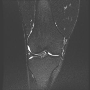 image of the inside of the knee